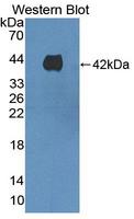HAVCR1 / KIM-1 Antibody - Western blot of HAVCR1 / KIM-1 antibody.