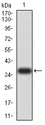 HAVCR1 / KIM-1 Antibody - Western blot analysis using HAVCR1 mAb against human HAVCR1 (AA: 70-290) recombinant protein. (Expected MW is 37 kDa)