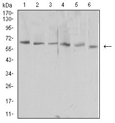HAVCR1 / KIM-1 Antibody - Western blot analysis using HAVCR1 mouse mAb against NIH/3T3 (1), HEK293 (2), Hela (3), Raw264.7 (4), Jurkat (5), and PC-2 (6) cell lysate.