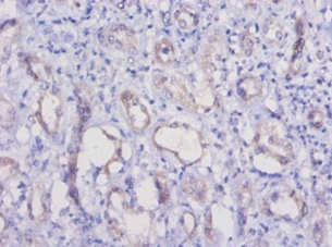 HAVCR1 / KIM-1 Antibody - Immunohistochemistry of paraffin-embeded human kidney at dilution of 1:50