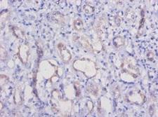 HAVCR1 / KIM-1 Antibody - Immunohistochemistry of paraffin-embeded human kidney at dilution of 1:50