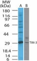 HAVCR2 / TIM-3 Antibody - Western blot of TIM-3 in A) mouse and B) rat kidney cell lysate using antibody at 2 ug/ml.