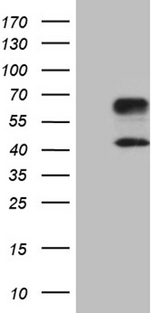HAVCR2 / TIM-3 Antibody - HEK293T cells were transfected with the pCMV6-ENTRY control. (Left lane) or pCMV6-ENTRY HAVCR2. (Right lane) cDNA for 48 hrs and lysed. Equivalent amounts of cell lysates. (5 ug per lane) were separated by SDS-PAGE and immunoblotted with anti-HAVCR2. (1:2000)