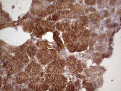 HAVCR2 / TIM-3 Antibody - Immunohistochemical staining of paraffin-embedded Human pancreas tissue within the normal limits using anti-HAVCR2 mouse monoclonal antibody. (Heat-induced epitope retrieval by 1 mM EDTA in 10mM Tris, pH8.5, 120C for 3min. (1:150)