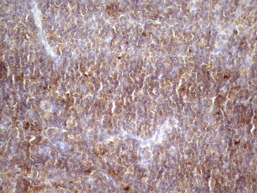 HAVCR2 / TIM-3 Antibody - Immunohistochemical staining of paraffin-embedded Human lymph node tissue within the normal limits using anti-HAVCR2 mouse monoclonal antibody. (Heat-induced epitope retrieval by 1 mM EDTA in 10mM Tris, pH8.5, 120C for 3min. (1:150)