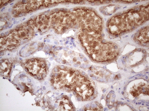 HAVCR2 / TIM-3 Antibody - Immunohistochemical staining of paraffin-embedded Human Kidney tissue within the normal limits using anti-HAVCR2 mouse monoclonal antibody. (Heat-induced epitope retrieval by 1 mM EDTA in 10mM Tris, pH8.5, 120C for 3min. (1:150)