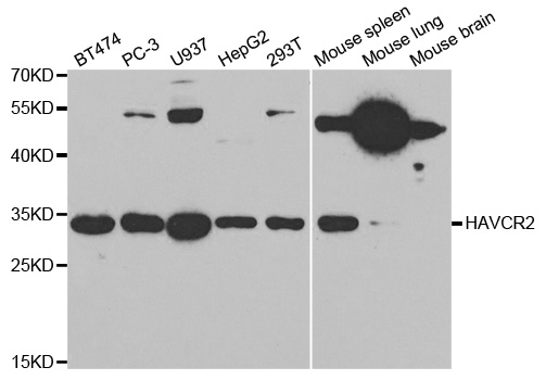 HAVCR2 / TIM-3 Antibody - Western blot analysis of extracts of various cell lines, using HAVCR2 antibody.
