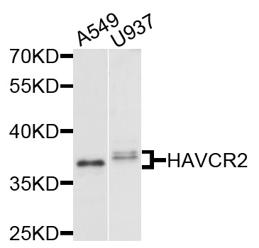 HAVCR2 / TIM-3 Antibody - Western blot analysis of extracts of various cells.