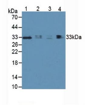 HAVCR2 / TIM-3 Antibody - Western Blot; Sample: Lane1: Human Lung Tissue; Lane2: Human Hepg2 Cells; Lane3: Human 293T Cells; Lane4: Porcine Lymph Node Tissue.