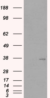 HAVCR2 / TIM-3 Antibody - HEK293 overexpressing HAVCR2 (RC209440) and probed with (mock transfection in first lane).
