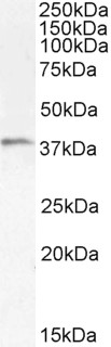 HAVCR2 / TIM-3 Antibody - Goat Anti-TIM3 / HAVCR2 Antibody (1µg/ml) staining of Human Tonsil lysate (35µg protein in RIPA buffer). Detected by chemiluminescencence.