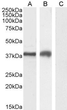 HAVCR2 / TIM-3 Antibody - Goat Anti-TIM3 / HAVCR2 Antibody (2µg/ml) staining of Jurkat (A), MOLT4 (B) and negative control A431 (C) cell lysate (35µg protein in RIPA buffer). Detected by chemiluminescencence.
