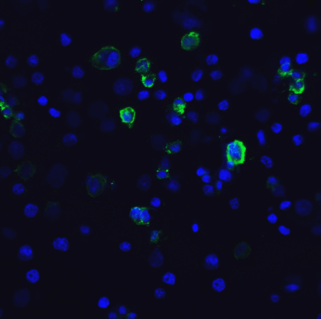 HAVCR2 / TIM-3 Antibody - Immunofluorescence of TIM-3 in transfected HEK293 cells with TIM-3 antibody at 10 ug/mL. Green: TIM-3 Antibody [1B10] Blue: DAPI staining