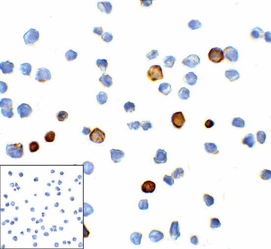 HAVCR2 / TIM-3 Antibody - Immunocytochemistry of TIM-3 in transfected HEK293 cells with TIM-3 antibody at 1 ug/mL. Lower left: Immunocytochemistry in transfected HEK293 cells with control mouse IgG antibody at 1 ug/mL.