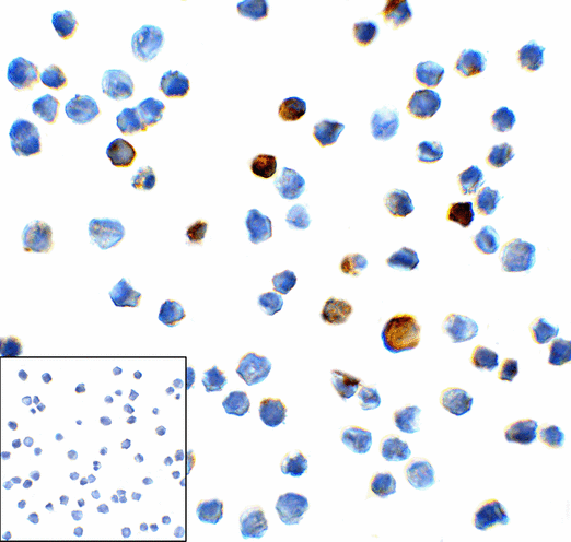 HAVCR2 / TIM-3 Antibody - Immunocytochemistry of TIM-3 in transfected HEK293 cells with TIM-3 antibody at 1 ug/mL. Lower left: Immunocytochemistry in transfected HEK293 cells with control mouse IgG antibody at 1 ug/mL.