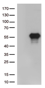 HAVCR2 / TIM-3 Antibody - HEK293T cells were transfected with the pCMV6-ENTRY control. (Left lane) or pCMV6-ENTRY HAVCR2. (Right lane) cDNA for 48 hrs and lysed