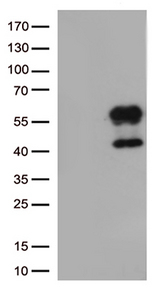 HAVCR2 / TIM-3 Antibody - HEK293T cells were transfected with the pCMV6-ENTRY control. (Left lane) or pCMV6-ENTRY HAVCR2. (Right lane) cDNA for 48 hrs and lysed