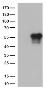 HAVCR2 / TIM-3 Antibody - HEK293T cells were transfected with the pCMV6-ENTRY control. (Left lane) or pCMV6-ENTRY HAVCR2. (Right lane) cDNA for 48 hrs and lysed