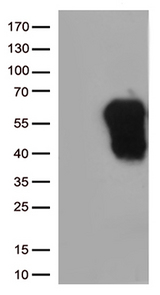 HAVCR2 / TIM-3 Antibody - HEK293T cells were transfected with the pCMV6-ENTRY control. (Left lane) or pCMV6-ENTRY HAVCR2. (Right lane) cDNA for 48 hrs and lysed