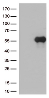 HAVCR2 / TIM-3 Antibody - HEK293T cells were transfected with the pCMV6-ENTRY control. (Left lane) or pCMV6-ENTRY HAVCR2. (Right lane) cDNA for 48 hrs and lysed