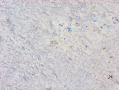 HAVCR2 / TIM-3 Antibody - Immunohistochemistry of paraffin-embedded Mouse kidney tissue using HAVCR2 Antibody at dilution of 1:50
