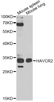 HAVCR2 / TIM-3 Antibody - Western blot analysis of extracts of various cell lines, using HAVCR2 antibody at 1:1000 dilution. The secondary antibody used was an HRP Goat Anti-Rabbit IgG (H+L) at 1:10000 dilution. Lysates were loaded 25ug per lane and 3% nonfat dry milk in TBST was used for blocking. An ECL Kit was used for detection and the exposure time was 90s.