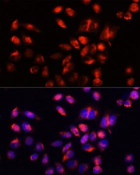 HAVCR2 / TIM-3 Antibody - Immunofluorescence analysis of Hela cells using HAVCR2 antibody at dilution of 1:100 (40x lens). Blue: DAPI for nuclear staining.