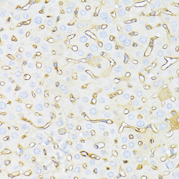 HAVCR2 / TIM-3 Antibody - Immunohistochemistry of paraffin-embedded mouse liver using HAVCR2 antibody at dilution of 1:100 (40x lens).