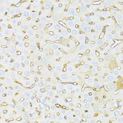 HAVCR2 / TIM-3 Antibody - Immunohistochemistry of paraffin-embedded mouse liver using HAVCR2 antibody at dilution of 1:100 (40x lens).
