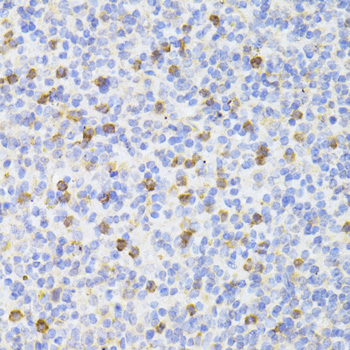 HAVCR2 / TIM-3 Antibody - Immunohistochemistry of paraffin-embedded mouse spleen using HAVCR2 antibody at dilution of 1:100 (40x lens).