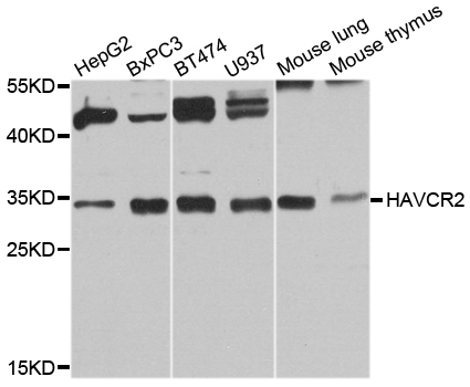 HAVCR2 / TIM-3 Antibody - Western blot analysis of extracts of various cell lines, using HAVCR2 antibody at 1:1000 dilution. The secondary antibody used was an HRP Goat Anti-Rabbit IgG (H+L) at 1:10000 dilution. Lysates were loaded 25ug per lane and 3% nonfat dry milk in TBST was used for blocking. An ECL Kit was used for detection and the exposure time was 10s.