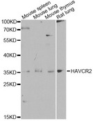 HAVCR2 / TIM-3 Antibody - Western blot analysis of extracts of various cell lines, using HAVCR2 antibody at 1:1000 dilution. The secondary antibody used was an HRP Goat Anti-Rabbit IgG (H+L) at 1:10000 dilution. Lysates were loaded 25ug per lane and 3% nonfat dry milk in TBST was used for blocking. An ECL Kit was used for detection and the exposure time was 15s.