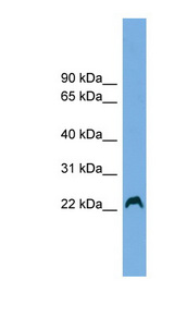HAX-1 Antibody - HAX1 antibody Western blot of Fetal Heart lysate. This image was taken for the unconjugated form of this product. Other forms have not been tested.