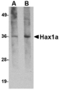 HAX-1 Antibody - Western blot of Hax1a in human brain tissue lysate with Hax1a antibody at (A) 1 and (B) 2 ug/ml