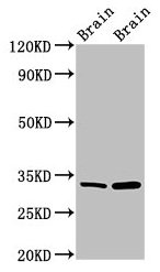 HAX-1 Antibody - Western Blot Positive WB detected in: Mouse brain tissue, Rat brain tissue All lanes: HAX1 antibody at 1.5µg/ml Secondary Goat polyclonal to rabbit IgG at 1/50000 dilution Predicted band size: 32, 33, 29, 15, 27, 22 kDa Observed band size: 32 kDa