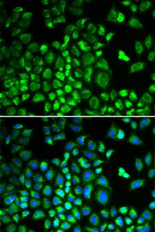 HAX-1 Antibody - Immunofluorescence analysis of A549 cells.