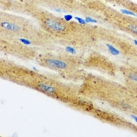 HAX-1 Antibody - Immunohistochemical analysis of HAX1 staining in mouse heart formalin fixed paraffin embedded tissue section. The section was pre-treated using heat mediated antigen retrieval with sodium citrate buffer (pH 6.0). The section was then incubated with the antibody at room temperature and detected using an HRP conjugated compact polymer system. DAB was used as the chromogen. The section was then counterstained with hematoxylin and mounted with DPX.