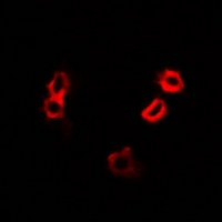 HAX-1 Antibody - Immunofluorescent analysis of HAX1 staining in A549 cells. Formalin-fixed cells were permeabilized with 0.1% Triton X-100 in TBS for 5-10 minutes and blocked with 3% BSA-PBS for 30 minutes at room temperature. Cells were probed with the primary antibody in 3% BSA-PBS and incubated overnight at 4 deg C in a humidified chamber. Cells were washed with PBST and incubated with a DyLight 594-conjugated secondary antibody (red) in PBS at room temperature in the dark.