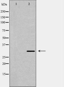 HAX-1 Antibody - Western blot analysis of mouse brain lysate using HAX1 antibody. The lane on the left is treated with the antigen-specific peptide.