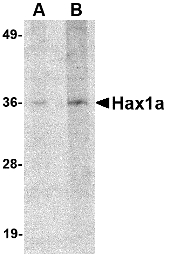 HAX-1 Antibody - Western blot of Hax1a in human brain tissue lysate with Hax1a antibody at (A) 1 and (B) 2 ug/ml