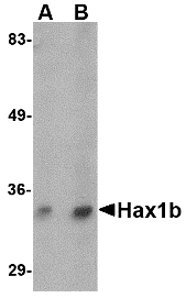 HAX-1 Antibody - Western blot of Hax1b in mouse brain tissue lysate with Hax1b antibody at (A) 1 and (B) 2 ug/ml