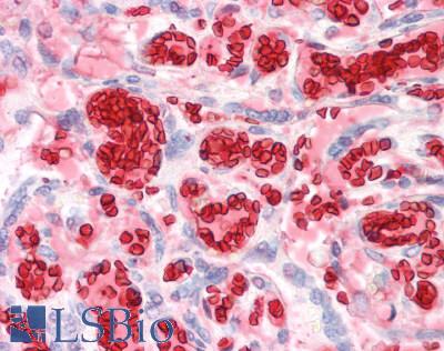 HBA1+2 / Hemoglobin Alpha Antibody - Human Placenta, Erythrocytes: Formalin-Fixed, Paraffin-Embedded (FFPE)