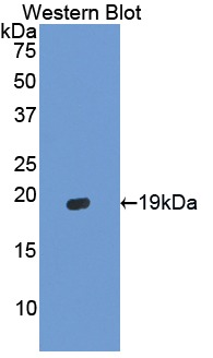 HBA1+2 / Hemoglobin Alpha Antibody - Western blot of HBA1 antibody.