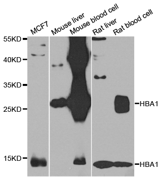 HBA1+2 / Hemoglobin Alpha Antibody - Western blot analysis of extracts of various cell lines.