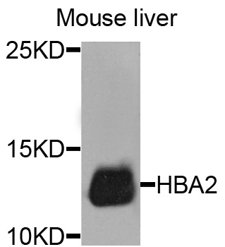 HBA1+2 / Hemoglobin Alpha Antibody - Western blot analysis of extracts of mouse liver cells.