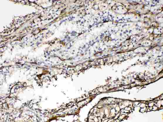 HBA1 Antibody - Immunohistochemistry - Anti-Hemoglobin Picoband Antibody