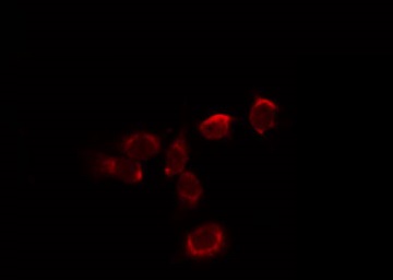 HBA2 / Hemoglobin Alpha 2 Antibody - Staining HepG2 cells by IF/ICC. The samples were fixed with PFA and permeabilized in 0.1% Triton X-100, then blocked in 10% serum for 45 min at 25°C. The primary antibody was diluted at 1:200 and incubated with the sample for 1 hour at 37°C. An Alexa Fluor 594 conjugated goat anti-rabbit IgG (H+L) Ab, diluted at 1/600, was used as the secondary antibody.