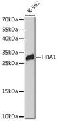 HBA2 / Hemoglobin Alpha 2 Antibody - Western blot analysis of extracts of K-562 cells using HBA1 Polyclonal Antibody at dilution of 1:3000.