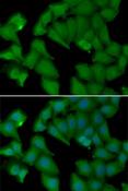 HBA2 / Hemoglobin Alpha 2 Antibody - Immunofluorescence analysis of MCF-7 cells using HBA1 Polyclonal Antibody.