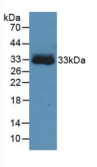 HBB / Hemoglobin Beta Antibody - Western Blot; Sample: Recombinant protein.
